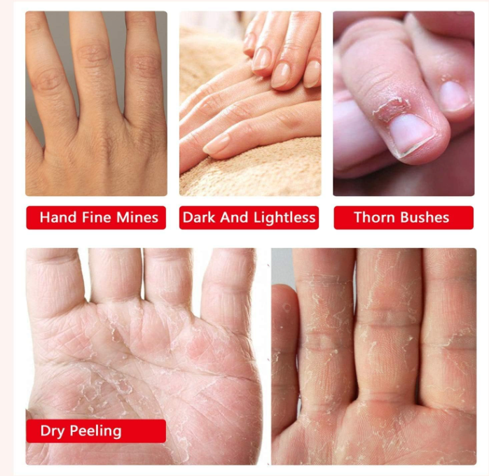 Purederm Twinkle Design Moisturizing Hand Mask - Hydratační maska na ruce s medem a propolisem (7)